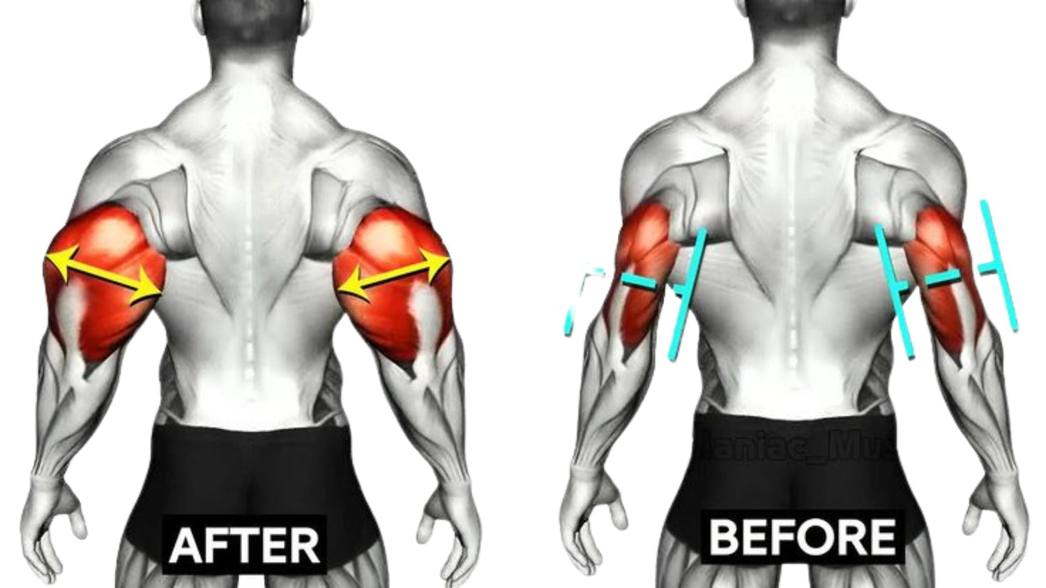 Long Head Tricep Exercise