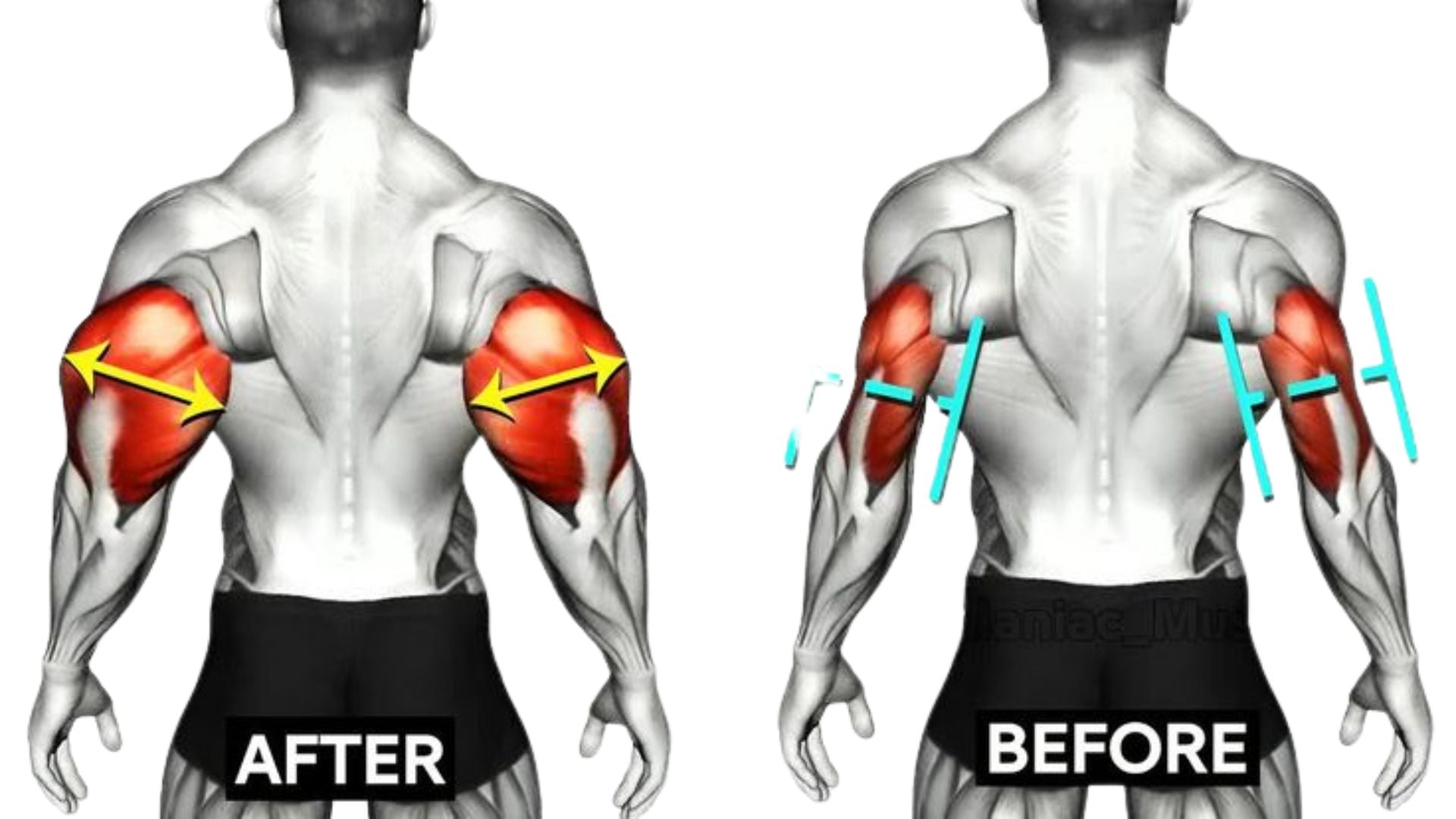 Long Head Tricep Exercise